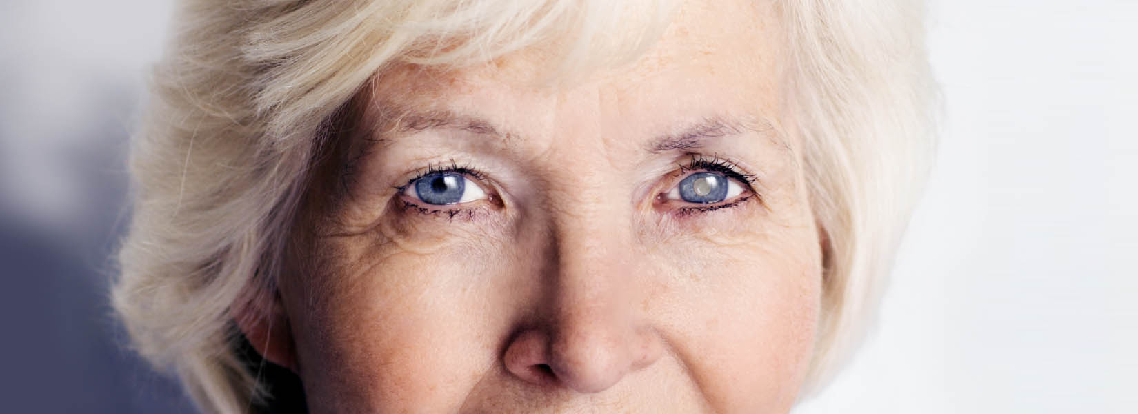 Cataract Surgery in Lincoln