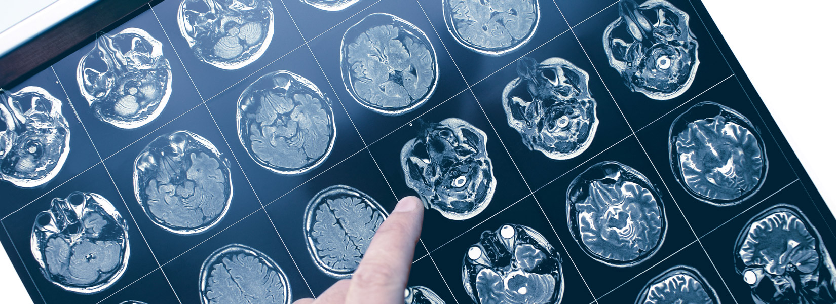 Neuro-Optometry in Lincoln