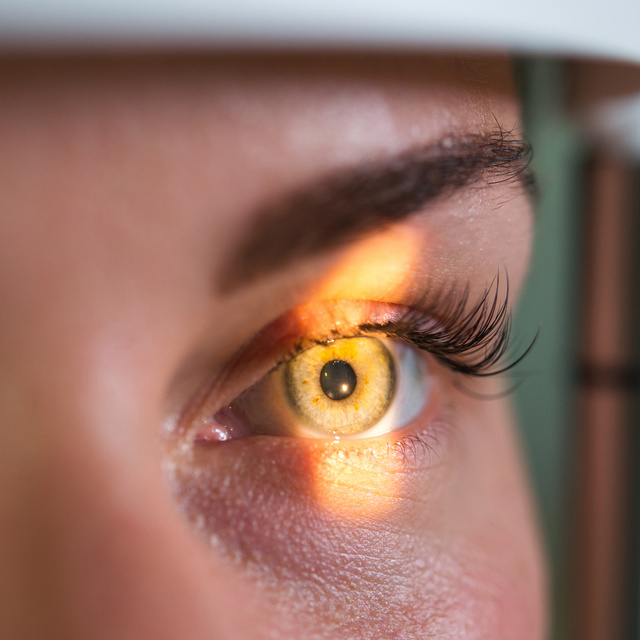 Vision Therapy in Lincoln